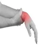 Wrist Injury Los Angeles Workers Comp Lawyer